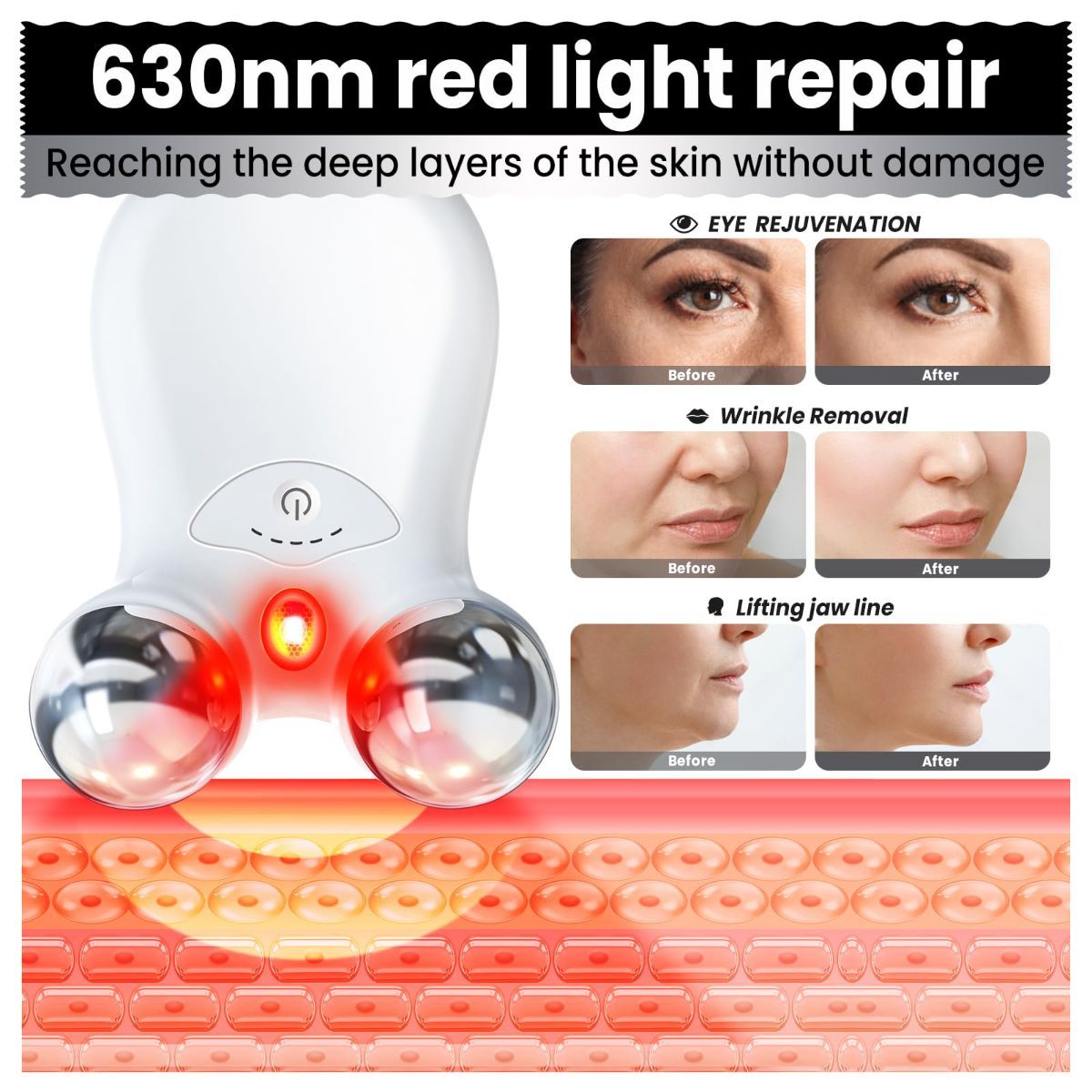 Microcurrent Facial Device,Latest Red Light Technology，Enhances The Ability to Lift The Face and Tighten The Skin，Facial Wrinkle Equipment，Smart Photon Micro-Current Device - White - Size 15cm